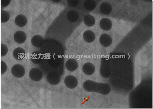 BGA因为焊垫变小，造成锡膏过多而最终形成焊接短路的结果。